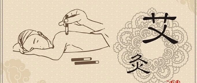 艾灸